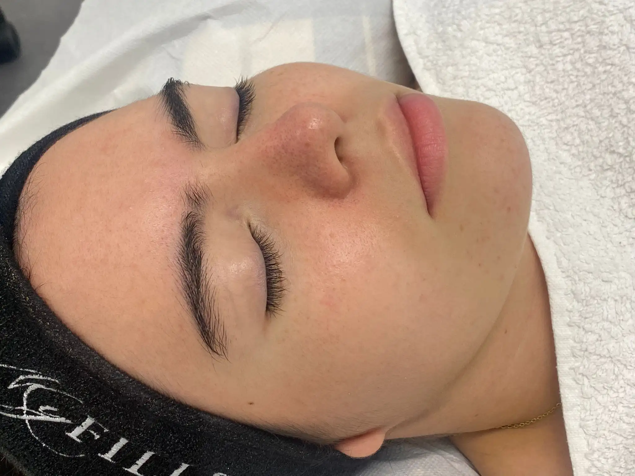 LimpezaDePele_01_Depois