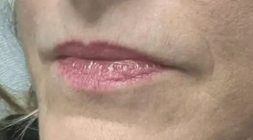 Preenchimento_04_Antes